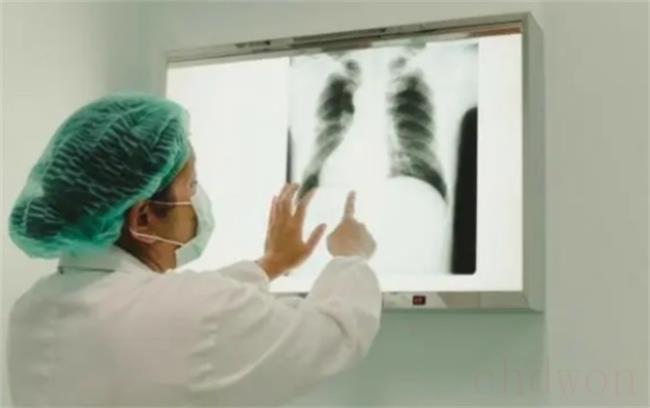 多地肺部CT检查需求激增有必要吗