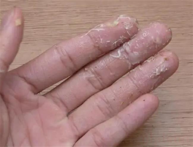 菠萝蜜的胶粘在手上怎么洗掉