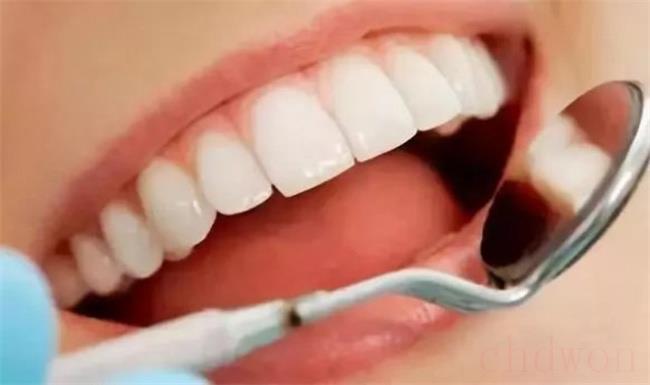 女子因洁牙感染梅毒？口腔机构做出什么回应？