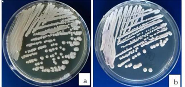 致命真菌微生物常见的有哪些