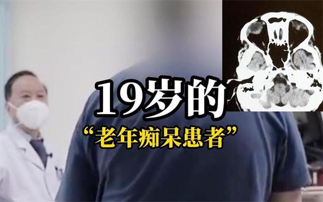 发现19岁阿尔兹海默症患者（目前是最年轻患者）