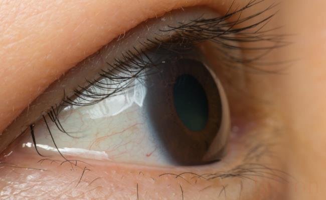 4岁娃眼睛痒就医发现睫毛爬满阴虱（应如何预防？）